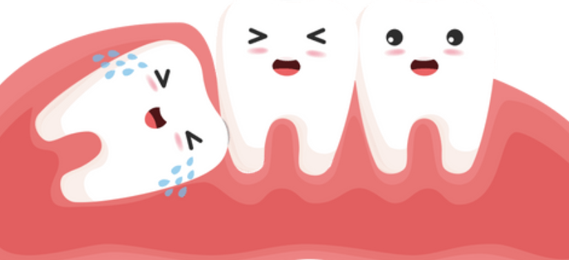 Wisdom Tooth Removal Cost with Insurance